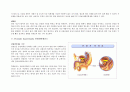 [간호학]Hypopharynx cancer문헌고찰 11페이지
