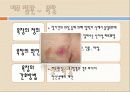 [간호학]노인간호학-피부 및 감각장애 대상자 간호 9페이지