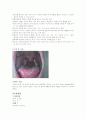 [간호학]Tonsillectomy & Adenoidectomy OR 실습 케이스 11페이지