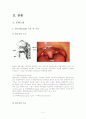 [간호학]Tonsillectomy(수술실 실습) 3페이지