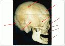 몸통뼈대(axial skeleton) 머리뼈(skull) 14페이지