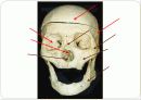 몸통뼈대(axial skeleton) 머리뼈(skull) 15페이지