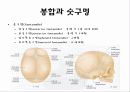 뒤통수뼈(occipital bone) 관자뼈(temporal bone) 나비뼈(sphenoid bone) 11페이지