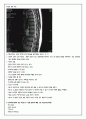 OS Case study, HNP케이스스터디, 성인간호학케이스스터디 13페이지