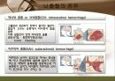 뇌졸중 간호와 재활 7페이지