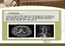 뇌졸중 간호와 재활 19페이지