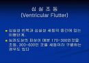 다형성 심실빈맥(Torsades de Points) 20페이지