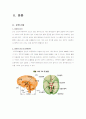 지주막하 출혈(Subarachnoid Hemorrhage SAH) case 3페이지