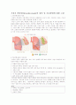 기관지 확장증 2페이지