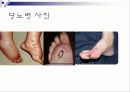 성인 당뇨병에 대하여 5페이지
