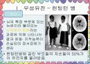 우성유전 열성유전에 따른 질병 3페이지