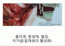 상악동 거상술 19페이지