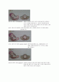 NSVD 자연분만 분만실 case 케이스 11페이지