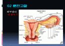 자연분만 NSVD 케이스 case 분만실 분만 ppt 5페이지