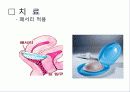 Uterine prolapse (자궁탈수증, 자궁탈출증) 12페이지