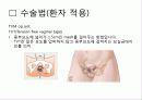 Uterine prolapse (자궁탈수증, 자궁탈출증) 34페이지