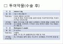 Uterine prolapse (자궁탈수증, 자궁탈출증) 42페이지