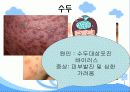 초등학교 전염병 교육 피피티 입니다. 많은 도움 되시길 바랍니다.  11페이지