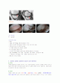 퇴행성관절염PBL입니다. 사례를 제시한후 문제를 뽑아서 간호적용하는것입니다.  6페이지