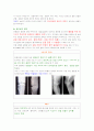 퇴행성관절염PBL입니다. 사례를 제시한후 문제를 뽑아서 간호적용하는것입니다.  7페이지