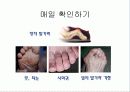 당뇨병환자의 발 관리 PPT 21페이지