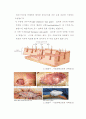 20110103화상환자case study-논문사례연구, 학사졸업제출 17페이지