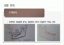 구강생리학 - 교합 10페이지