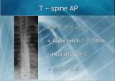 X-Ray spine 촬영(1) 8페이지