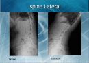 X-Ray spine 촬영(1) 13페이지