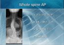 X-Ray spine 촬영(1) 14페이지