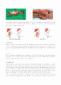 ICU Case)외과중환자실(SICU) 췌장암 case study(케이스스터디) 6페이지