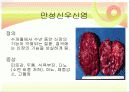 신장질환 및 신장의 식이요법 7페이지