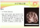 신장질환 및 신장의 식이요법 18페이지