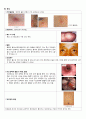 성인간호학 (소화기내과) 간경변증 3페이지