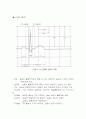 심장활동의 기전과 심전도_ECG 6페이지