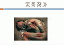 신체형장애발표 - 신체화 장애, 전환장애, 통증장애, 건강염려증, 신체변형장애 22페이지