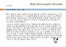 신체형장애발표 - 신체화 장애, 전환장애, 통증장애, 건강염려증, 신체변형장애 51페이지