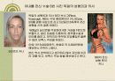 신체 변형 장애 (성형중독) 13페이지