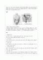 hemorrhoid (치질) 2페이지