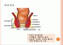 Hemorrhoid 치핵 4페이지