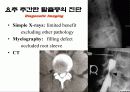 추간판 탈출증(디스크질환)  14페이지