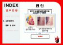 심장질환의 종류 및 분석 예방법 19페이지