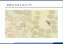 응급실에서 발열의 감별진단 30페이지