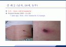 응급실에서 발열의 감별진단 37페이지