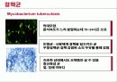 Tb CASE STUDY 건강문제와 간호1 -  결핵 3페이지