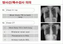 Tb CASE STUDY 건강문제와 간호1 -  결핵 13페이지