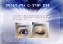 성형수술 그것이 알고 싶다 8페이지
