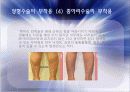 성형수술 그것이 알고 싶다 10페이지