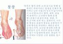 발과 인체의 건강 9페이지