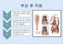 기계체조 선수의 무릎부상과 예방 7페이지